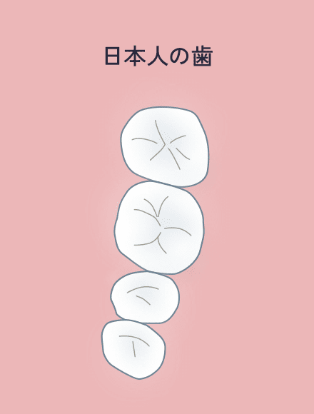 日本人の歯