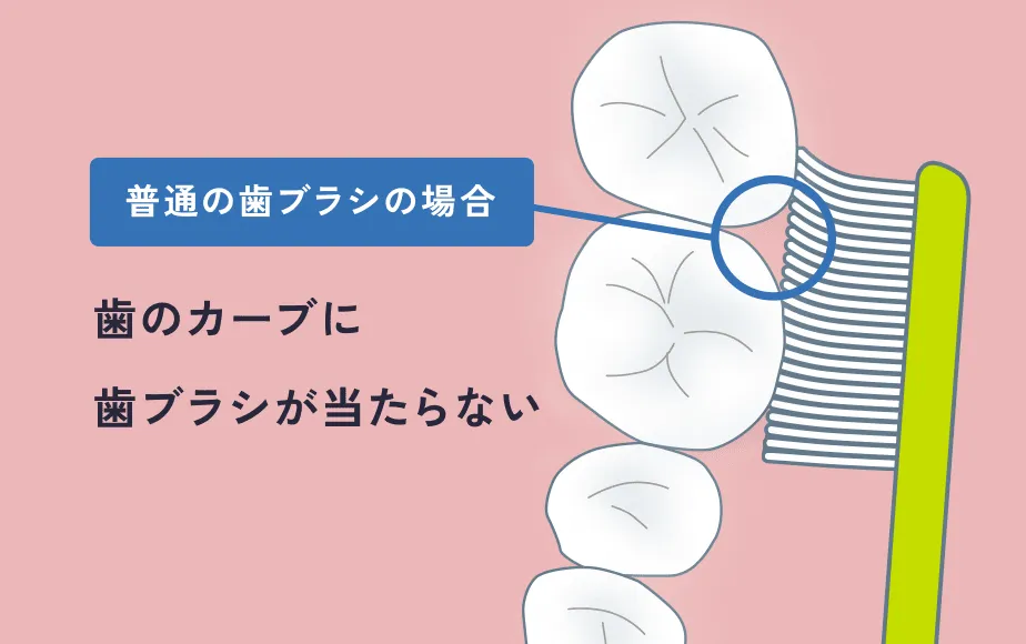 普通の歯ブラシの場合、歯のカーブに歯ブラシが当たらない